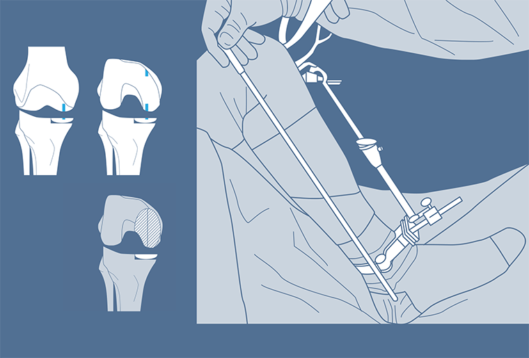Surgical Process Institute - 7