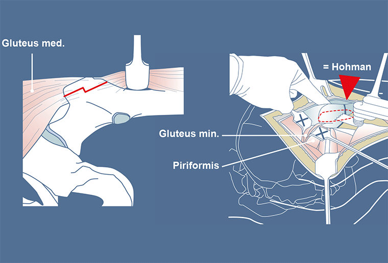 Surgical Process Institute - 9