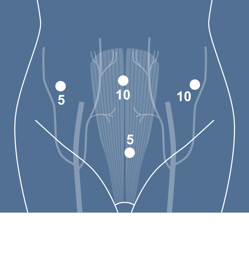 Surgical Process Institute