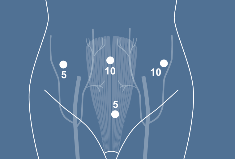 Surgical Process Institute - 1