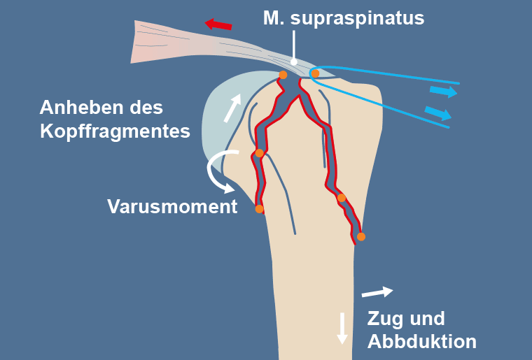 Surgical Process Institute - 3