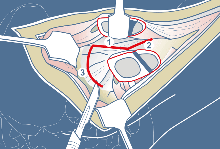 Surgical Process Institute - 4