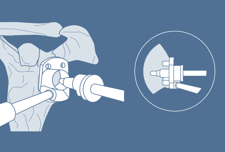 Surgical Process Institute - 6