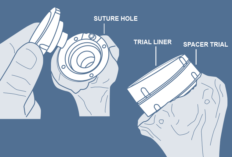 Surgical Process Institute - 7